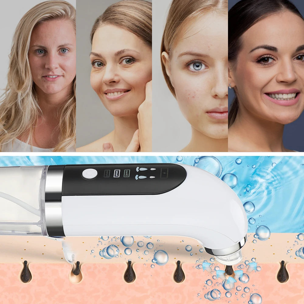 Blackhead Removal Pore Vacuum Face Cleaner Electric Pimple Black Head Remover USB Rechargeable Water Cycle Facial Cleaning Tools